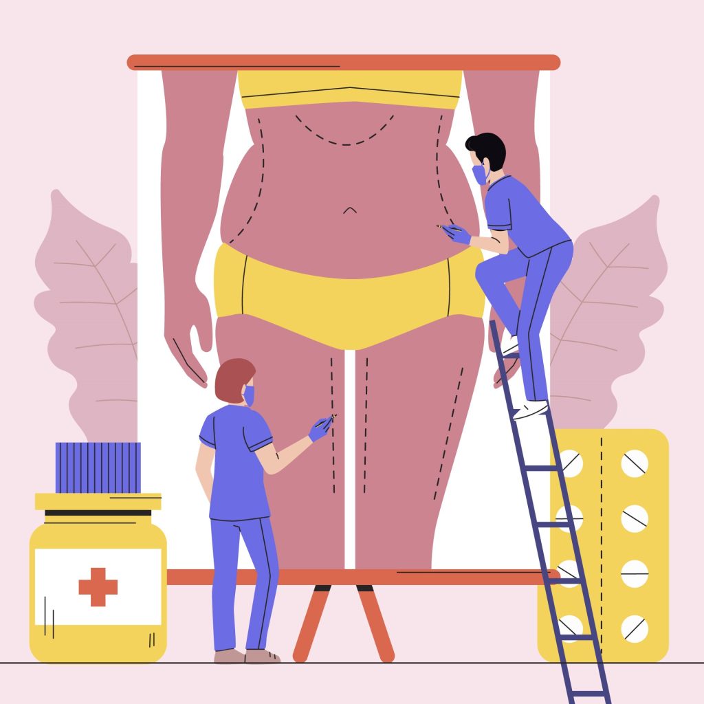 Steps for effective Weight Loss Surgery?
